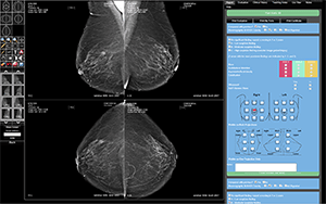 DICOM Viewer